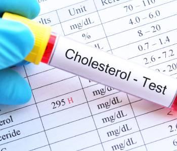 cnim_cholesterol