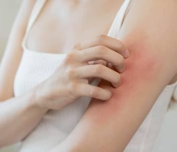 cnim_skin_rashes